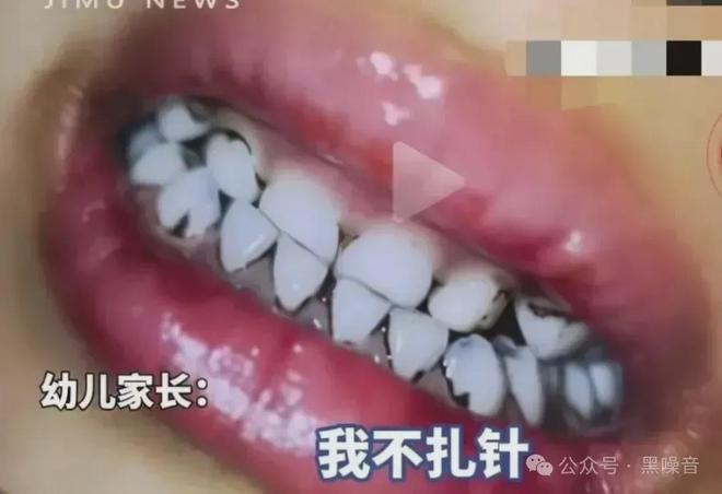 天水幼儿园铅中毒真相到底是什么？(图6)